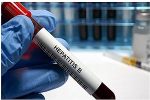 هپاتیت B و C می‌توانند سال‌ها بدون علامت باشند