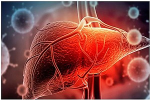 کمتر از 1 درصد جمعیت ایران به &quot;هپاتیت B&quot; مبتلا هستند