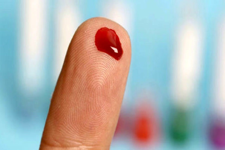تصویر تشخیص چند دقیقه‌ای سلامتی بدن با کمک یک قطره خون