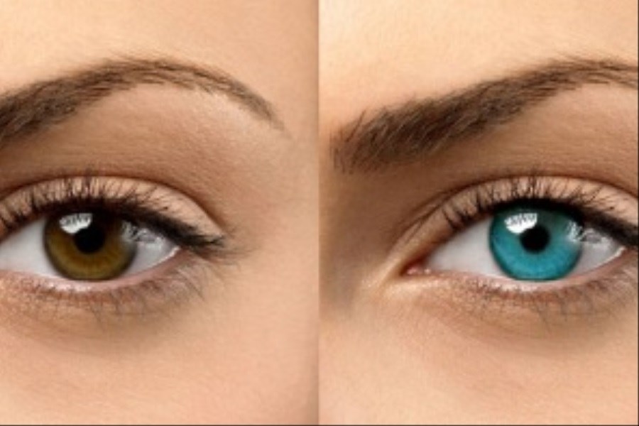 تصویر چه کسانی مجاز به تغییر رنگ چشم هستند؟