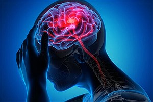 کاهش عوارض سکته مغزی با تشخیص زودهنگام