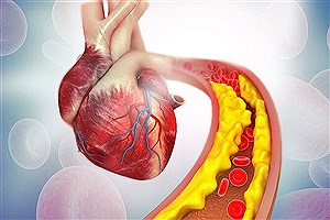 بدترین خوراکی‌ها برای افزایش کلسترول خون