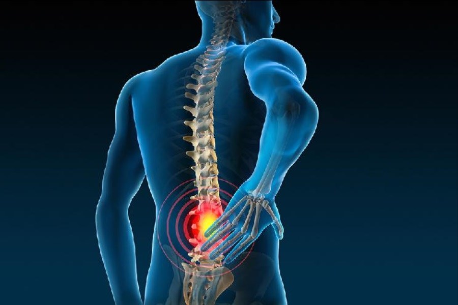 چطور درد عضلات و مفاصل را بدون داروهای خوراکی کاهش دهیم؟