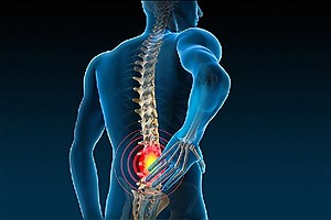 چطور درد عضلات و مفاصل را بدون داروهای خوراکی کاهش دهیم؟