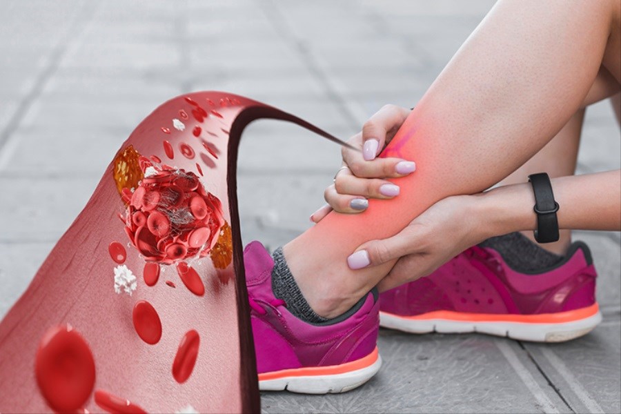 ۸ ویتامین معجزه‌گر که پاها را قوی‌تر می‌کنند