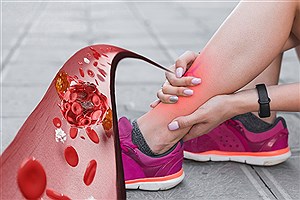 ۸ ویتامین معجزه‌گر که پاها را قوی‌تر می‌کنند