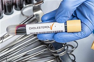 آزمایش Cholesterol + شرایط انجام آن