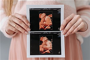اصلاح سبک زندگی و افزایش 30 درصدی بارداری