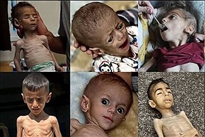 نگذارید غزه از گرسنگی و تشنگی بمیرد