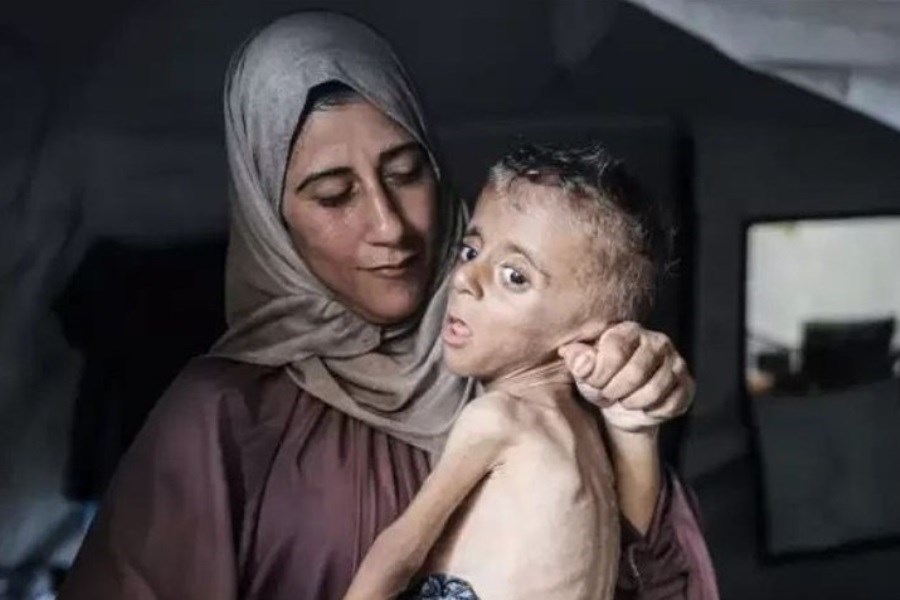 تصویر یک‌پنجم کودکان غزه نارس یا کم‌وزن به دنیا می‌آیند