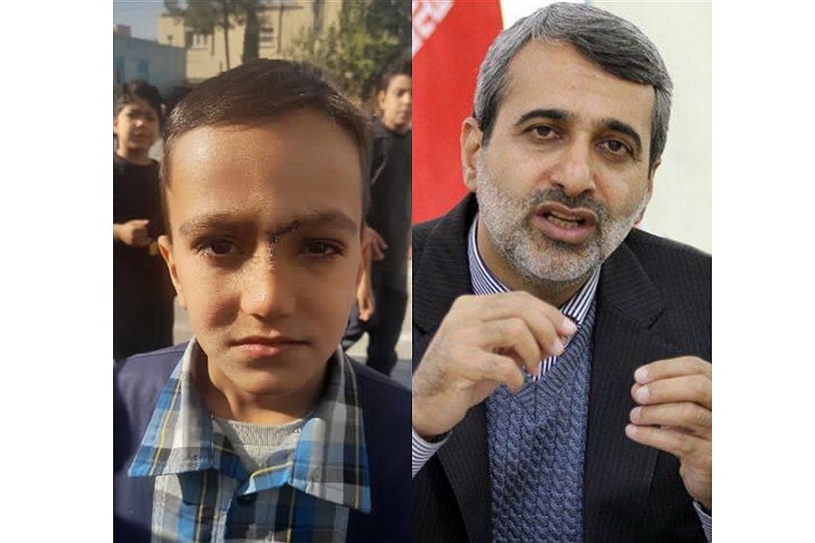 تصویر ورود نماینده مجلس به ماجرای دانشآموز رهنانی؛ بیمه هزینهها را میدهد تصویر ورود نماینده مجلس به ماجرای دانشآموز رهنانی؛ بیمه هزینهها را میدهد