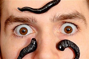 مقابله با بیماری پسوریازیس به کمک «زالو درمانی»