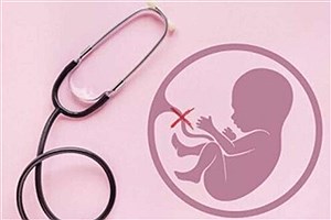 روایت وزارت بهداشت از سقط‌های قانونی و غیرقانونی