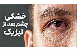 خشکی چشم بعد از لیزیک؛ نگرانی بی‌مورد یا موضوعی جدی؟