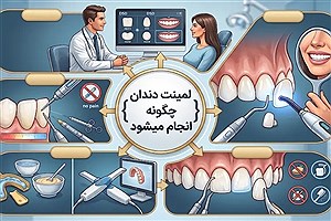 لمینت دندان چگونه انجام میشود