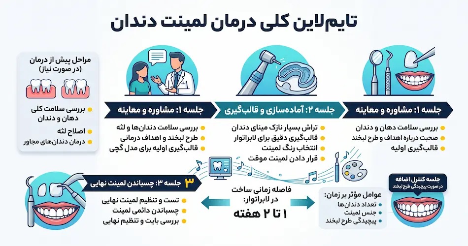 لمینت دندان در چند جلسه انجام می‌شود؟ (تایم‌لاین کلی)