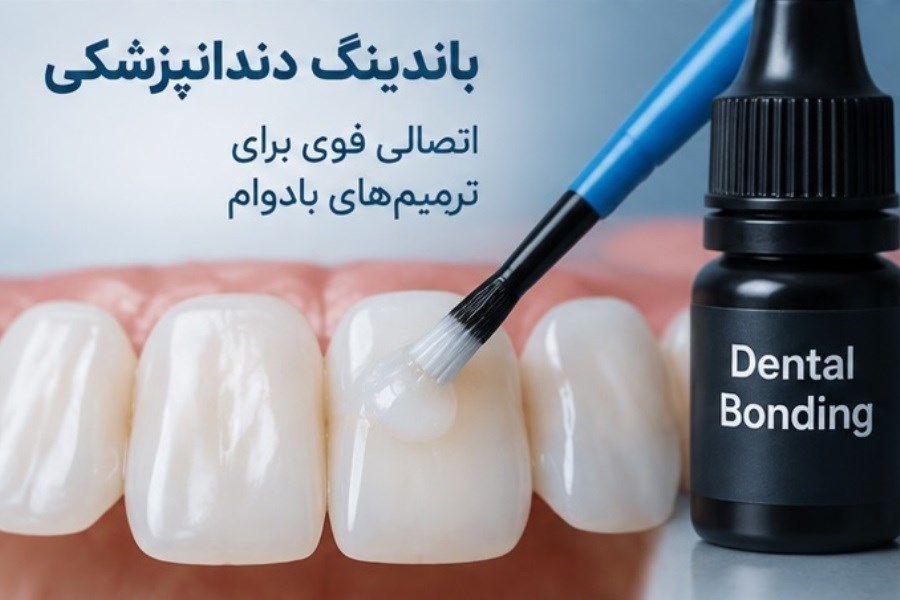 باندینگ دندانپزشکی برای ایجاد اتصال قوی در ترمیم دندان