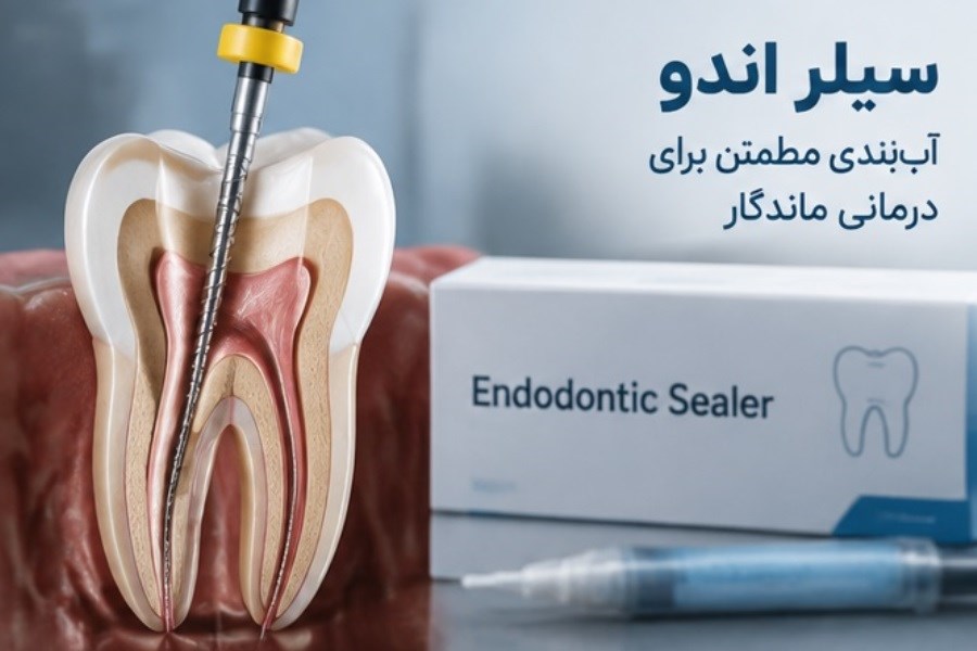 سیلر اندو دندانپزشکی برای آب بندی بهتر کانال ریشه